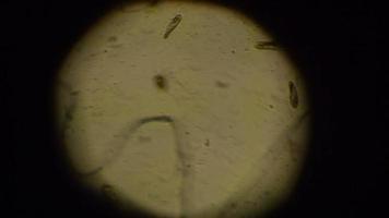 paramecium caudatum considerando el microscopio. Paramecium caudatum se mueve en una gota de agua video