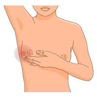 Woman performing monthly self exam for breast cancer, feeling pain vector