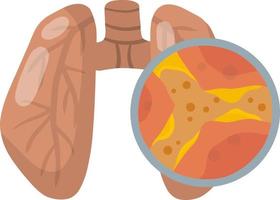 enfermedad pulmonar. obstrucción del canal. moco en los alvéolos. problemas respiratorios. vista ampliada bajo el microscopio. bronquios y bronquitis. material médico educativo plano. vector