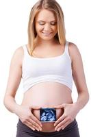 His first photo. Cheerful pregnant woman holding x-ray image of baby in front of her abdomen while standing isolated on white photo