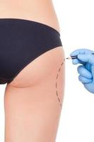 Preparation for hips improvement. Cropped image of female buttocks and doctors hand in protective glove sketching it while isolated on white background photo