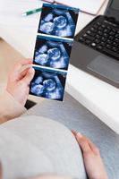 Woman with sonogram picture. Cropped image of woman holding sonogram picture while sitting at the table with laptop on it photo
