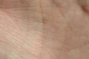 Close up of human hand skin with visible skin texture and lines photo