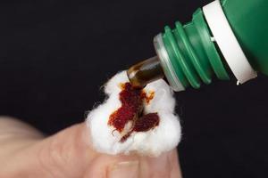 cotton wool and iodine, treatment of radioactive exposure with iodine solution photo