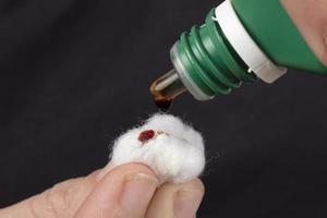 cotton wool and iodine, treatment of radioactive exposure with iodine solution photo