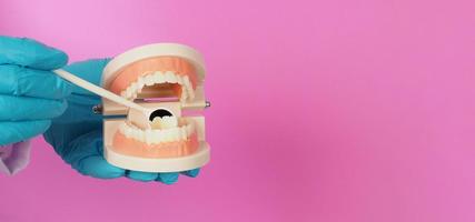 Hands is hold Orthodontic model of teeth and Dental mirror on pink background.Hand wear blue latex glove. photo