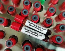 Bloods sample for short Synacthen test. Before injection and after injection. ACTH Stimulation test. photo