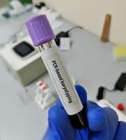 Blood sample for PCR based karyotyping testing. Genetic disorder. chromosomal analysis. photo