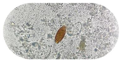 Eggs of Trichuris trichiura whipworm in stool, analyze by microscope photo