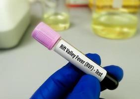 Rift valley fever virus test, an RNA virus of Bunyaviridae family, transmitted from infected animals by mosquito bite or air which is responsible for Rift valley fever. photo