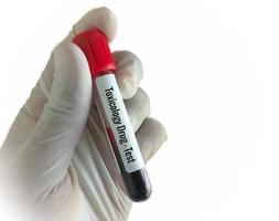 Biochemist holding blood sample with white background for Toxicology drug testing. photo