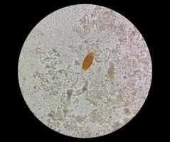 Eggs of Trichuris trichiura whipworm in stool, analyze by microscope photo