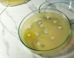 Antimicrobial susceptibility testing in petri dish. Antibiotic resistance of bacteria photo