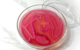 Bacteria colony on culture media plate, stool culture photo