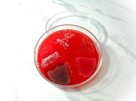 Petri dish isolated with Bacterial colony on blood agar meidum. Microbial culture. white background. photo