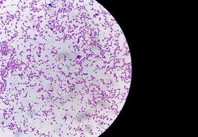 Gram staining, also known as Gram's method, is a method of differentiating bacterial species into two large groups photo