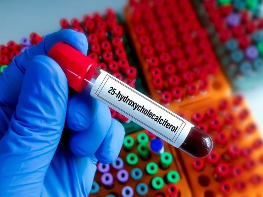 Cholesterol Test Stock Photos Images And Backgrounds For Free Download cholesterol-test-stock-photos-images-and-backgrounds-for-free-download