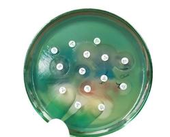 Antimicrobial susceptibility testing in petri dish. Antibiotic resistance of bacteria photo