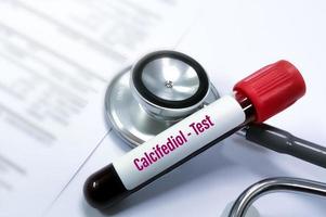 Blood sample for 25 hydroxyvitamin D3 test, also known as calcifediol, calcidiol, 25 hydroxycholecalciferol is a form of vitamin D produced in the liver by hydroxylation of vitamin D3 photo