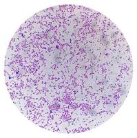 Gram staining, also known as Gram's method, is a method of differentiating bacterial species into two large groups photo