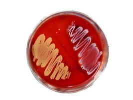 colonia bacteriana en agar sangre en placa petri. medios de cultivo bacterianos. microbiólogo. bacteria. foto