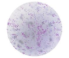 Gram staining, also known as Gram's method, is a method of differentiating bacterial species into two large groups photo