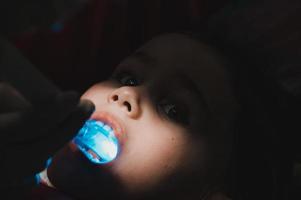 Ultraviolet light in dentistry, the dentist holds a device with ultraviolet light to quickly seal the filling in the child's tooth. photo