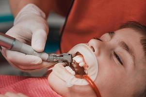 el dentista limpia la caries dental en un niño con un taladro, en la saliva eyectora de la boca del niño. foto