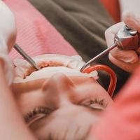 tratamiento dental de un niño, eliminación de caries con un taladro, boca abierta y eyector de saliva. foto