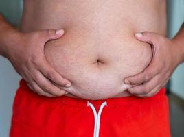 un hombre con sobrepeso en pantalones cortos rojos sostiene su gran barriga. el concepto de la necesidad de deportes y nutrición adecuada foto