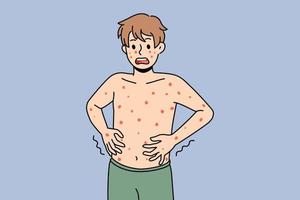 Unhealthy boy with red spots on body suffer from measles or rubella. Anxious unwell man struggle with rash fever, have severe symptoms. Healthcare concept. Flat vector illustration.