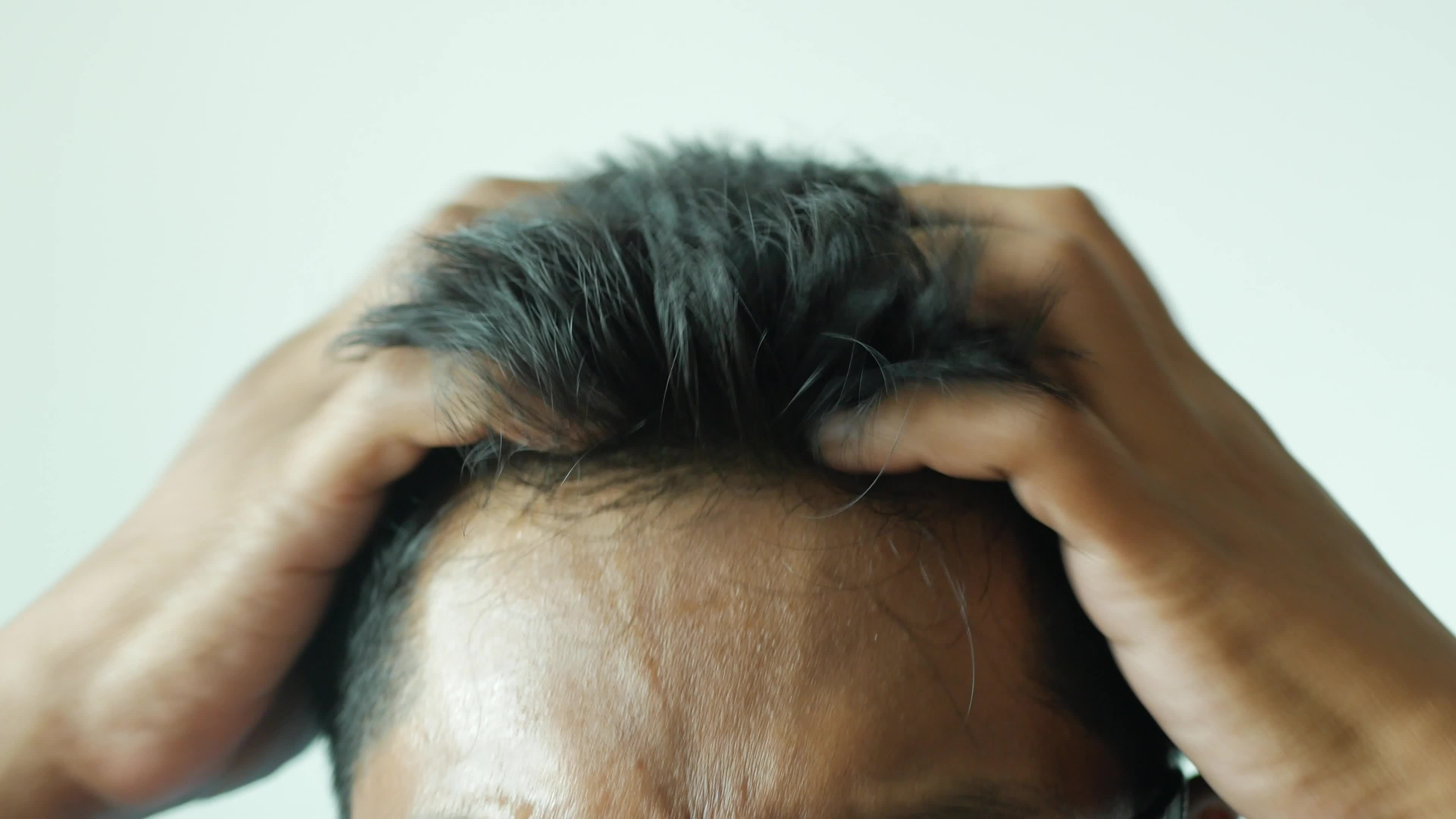 Adult man rubs and scratches hair and scalp close up 13710118 Stock