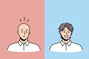 Hair loss and baldness concept. Faces of young completely bald man with frustrated mood and happy smiling hairy person vector illustration