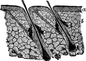 Cross Section of Human Skin, vintage illustration. vector