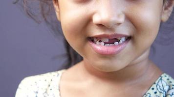 menina sorrindo com seus novos dentes video