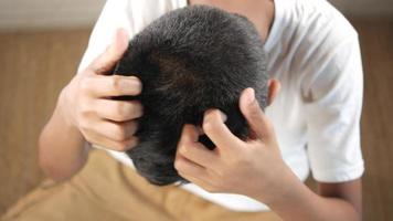 Overhead view of a young man scratching head and scalp video