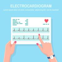 cardiograma en la mano del médico. diagnóstico de enfermedades cardiovasculares. gráfico del ritmo de los latidos del corazón. documento de electrocardiograma vector