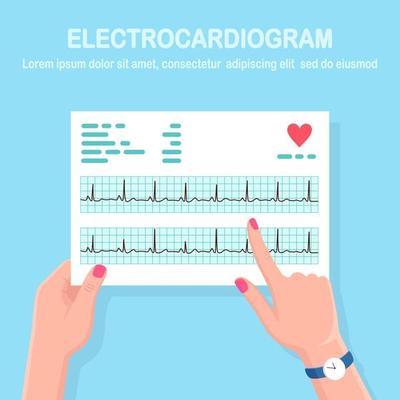 Cardiogram in doctor hand. Diagnosis cardiovascular disease. Chart of heart beat rhythm. Ecg document