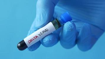 Gloved hand holding a test tube of delta virus video