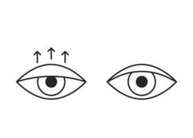 ojo de comparación con ptosis del párpado hacia abajo y párpado sano, icono de línea. blefaroplastia, cirugía de párpados. corrección de la vista estética del ojo. ilustración vectorial vector