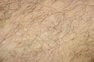 Close up detail of human skin with hair. Mans hairy leg photo