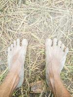 dos pies de un granjero con piel seca foto