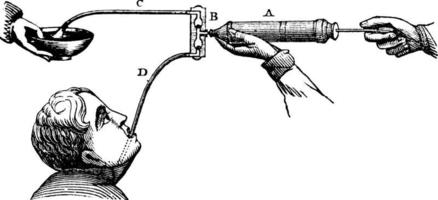 Stomach Pump, vintage illustration. vector