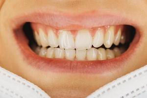 primer plano de una boca sonriente de dientes de una mujer foto