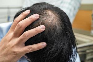 calvo en la cabeza media y sin pérdida de cabello glabro de hombre de oficina activo inteligente de negocios asiáticos maduros. foto