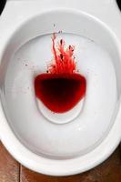 A white ceramic toilet bowl is stained with blood. The consequences of pronounced menstruation, dysbacteriosis, dysentery, haemorrhoids, cancer and other diseases with similar symptoms photo