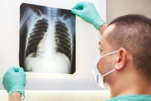 mano de hombre sosteniendo una radiografía de pulmones aislada sobre fondo blanco. médico con máscara y guantes mirando la radiografía de tórax foto