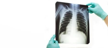 mano de hombre sosteniendo una radiografía de pulmones aislada sobre fondo blanco. médico con máscara y guantes mirando la radiografía de tórax foto