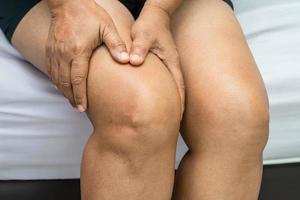 Asian lady woman patient touch and feel pain her knee, healthy medical concept. photo