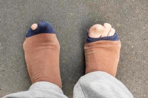 Male legs with protruding toes in holey worn socks, on a gray floor. Top view. photo